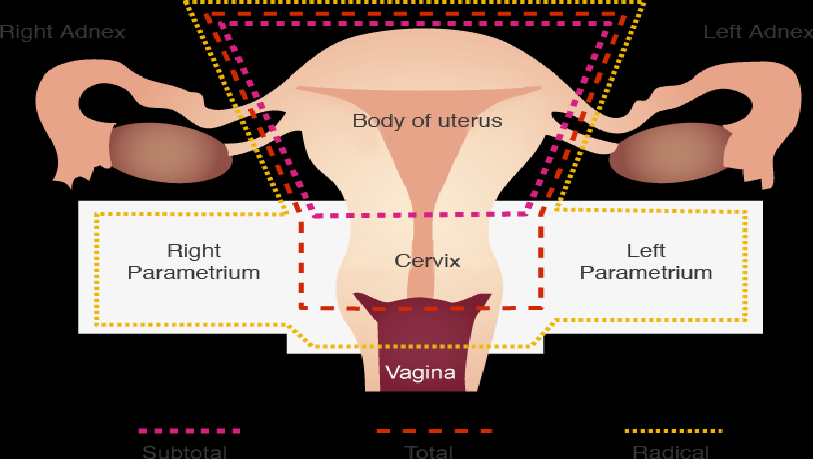 Fibroid Treatment Methods Are Worth Considering